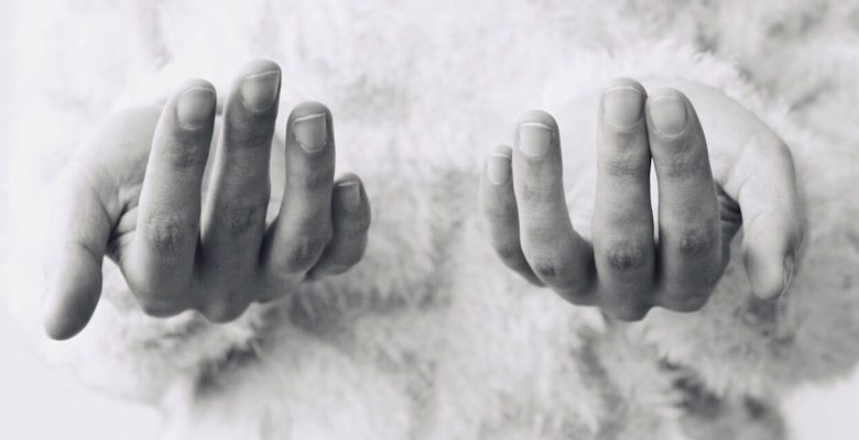 Un'immagine di una nuova applicazione per smartphone che rileverà l'anemia utilizzando solo le unghie notizie-anemia-unghie-in primo piano