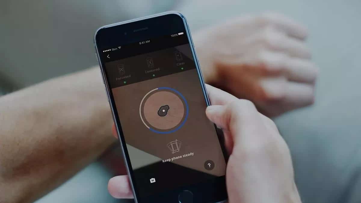 Imagen de las mejores aplicaciones de cuidado de la piel para iOS y Android | skinvision-ooWc3egs-DzTechs
